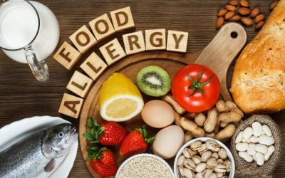 Everything you need to know about food allergies